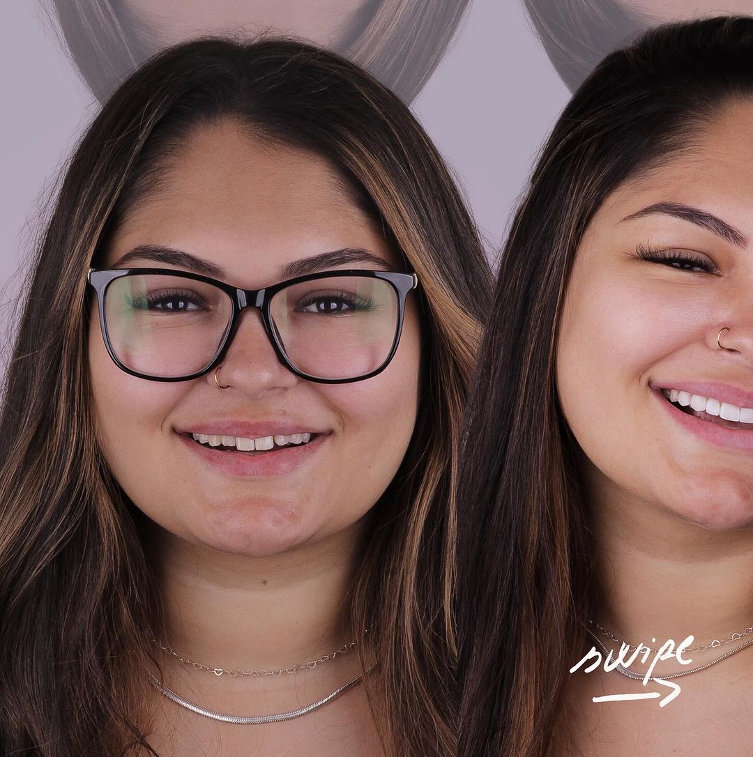 dra.fernandadiias_421598678_18410873332047114_1599592699395333930_n