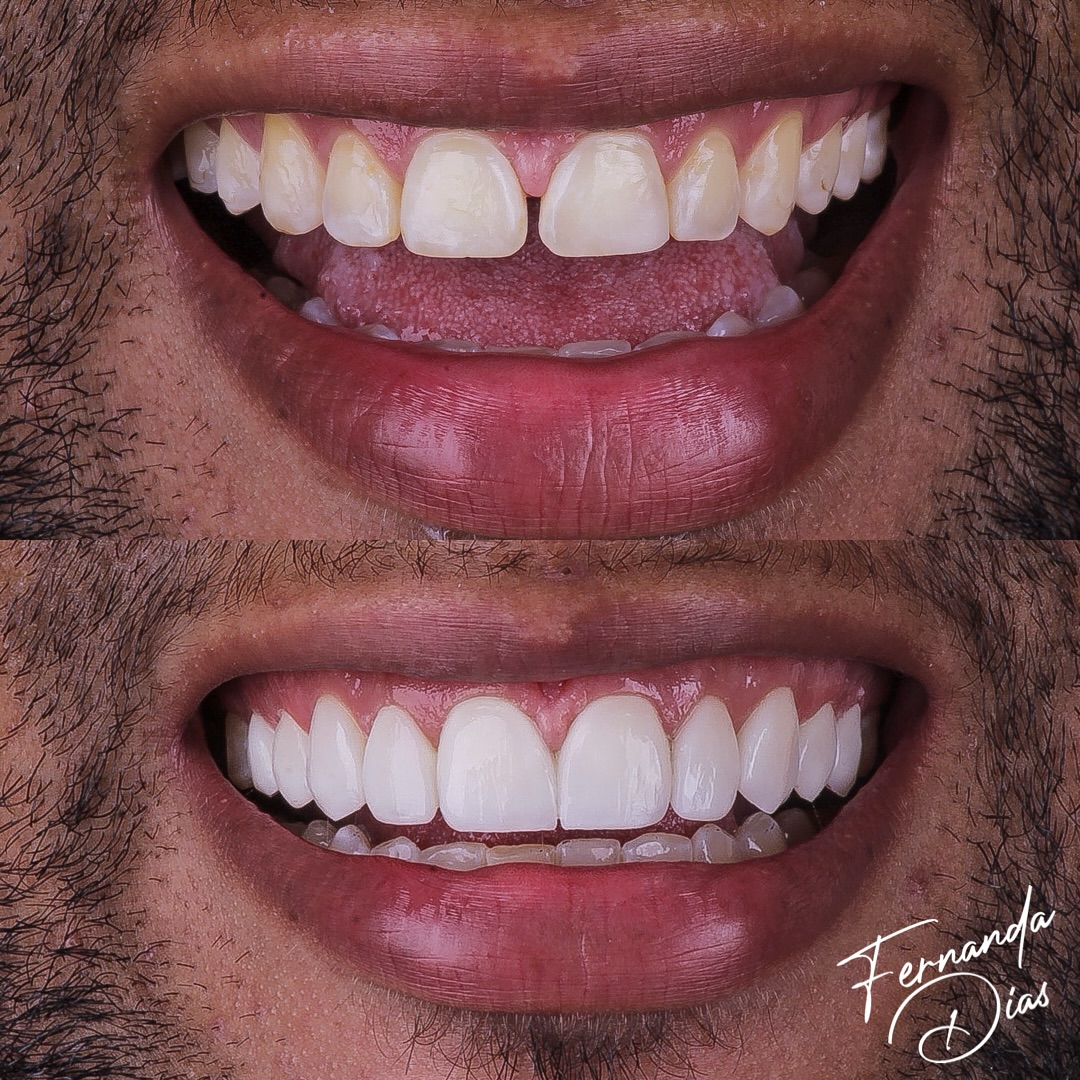 dra.fernandadiias_423312709_18411765730047114_1806412650759361248_n