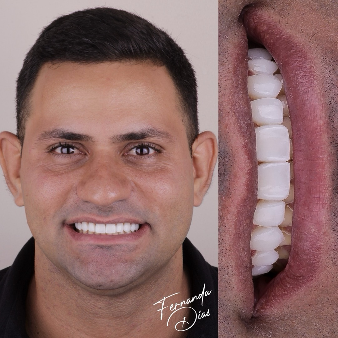 dra.fernandadiias_424655195_18412443211047114_699786581843959777_n