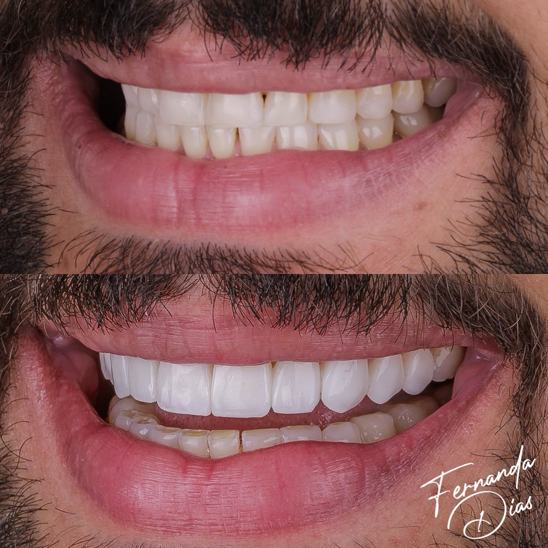 dra.fernandadiias_425713841_18412982590047114_459240681125798783_n