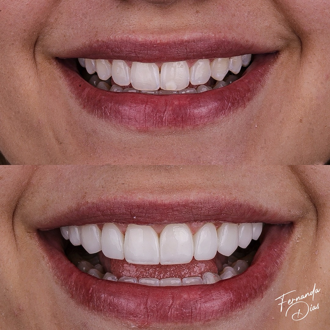 dra.fernandadiias_426538131_18414734818047114_4670204795833949233_n