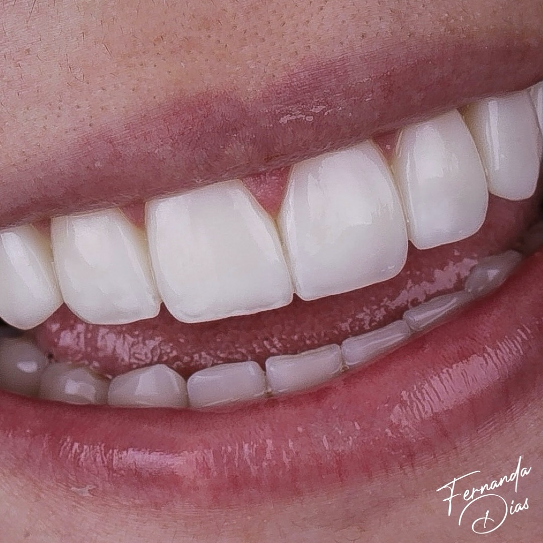 dra.fernandadiias_428638152_18415421383047114_8601167188383926645_n