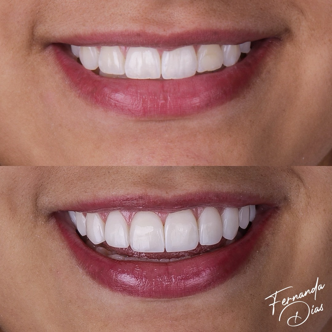 dra.fernandadiias_429806066_18421710262047114_3232741792763439613_n